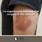 I'm Experiencing Bruising After Shoulder Surgery. Is this Normal ...