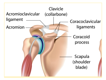 What's an AC Joint Injury and How is it Treated? - Focus Shoulder