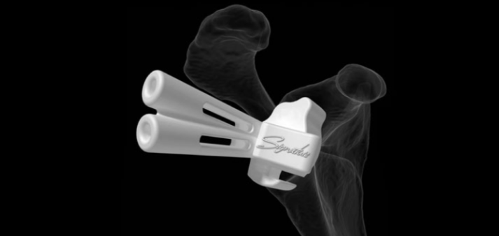 shoulder replacement